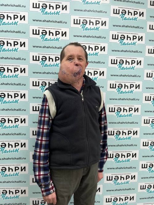 Блогер Марат Юнысов: «Бәрәңге казыган вакытта апа үлеп китте....»