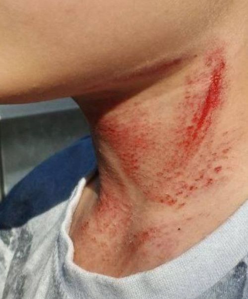 Тукай районында бер бала муенын кистерә язган