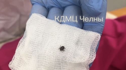 Чаллыда талпан кадалуның беренче очрагы теркәлде
