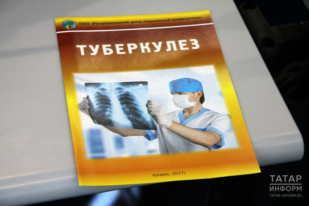 Россиядә даруларга бирешми торган туберкулез штаммын тапканнар