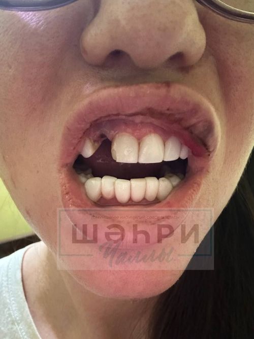 Чаллы блогеры Дания Дәүләтьянованың кызына Һиндстанда һөҗүм иткәннәр