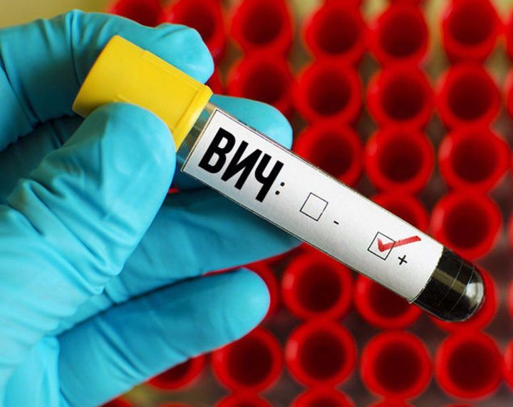 Татарстанда ВИЧ-инфекция йоктыручылар арта